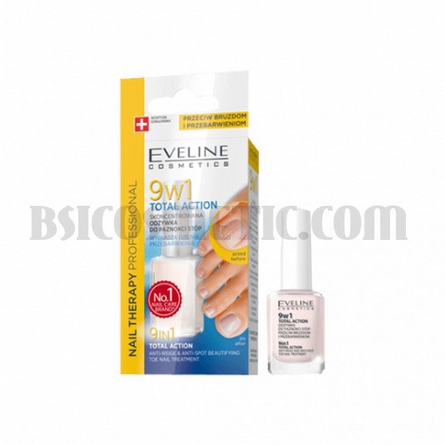 Eveline Foot Nails Therapy Балсам за грижа на ноктите на ходилата 9в1 Total Action